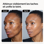 Routine éclat Anti - tâches