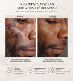 Mon sérum unifiant, anti-tâches 15ML