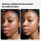 Routine éclat Anti - tâches