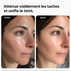 Routine correction anti-inflammatoire et anti-tâches