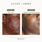 Routine correction anti-inflammatoire et anti-tâches