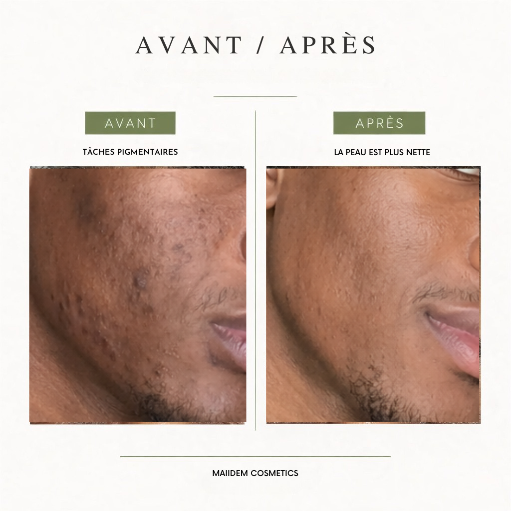 Routine éclat Anti - tâches