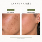 Sérum unifiant, anti-tâches 15ML